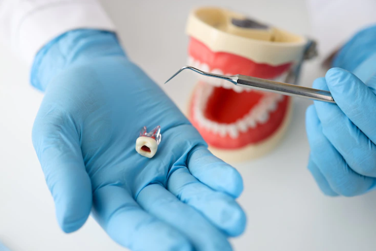 painless root canal treatment in Dwarka