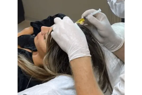 Mesotherapy In Istanbul