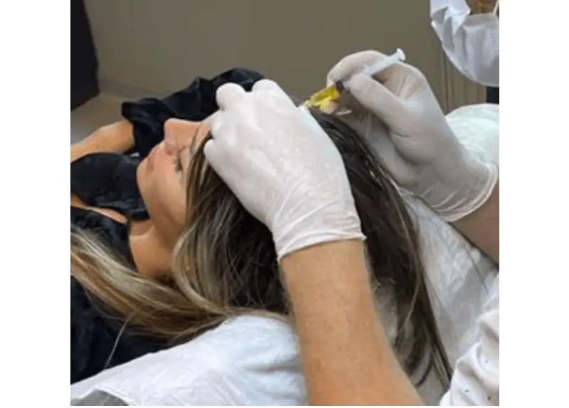 Mesotherapy In Istanbul
